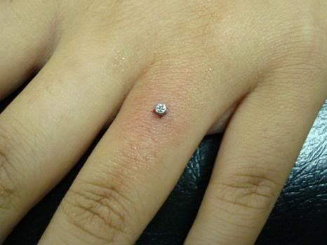 fingerdermal.jpg